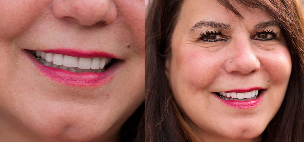 Woman smiling after Dentures