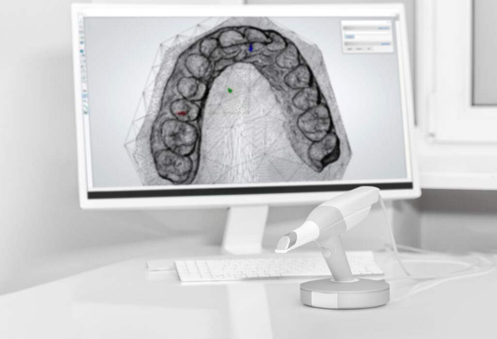 Digital Dentures - Dental 3D Scanner in Dentist's Office